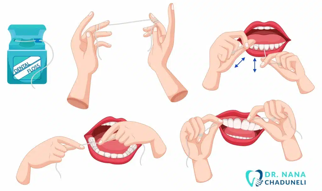 როგორ გავიხეხოთ კბილები სწორად 6 ფლოსი - ეს არის სტომატოლოგიური ძაფი, კბილებისთვის