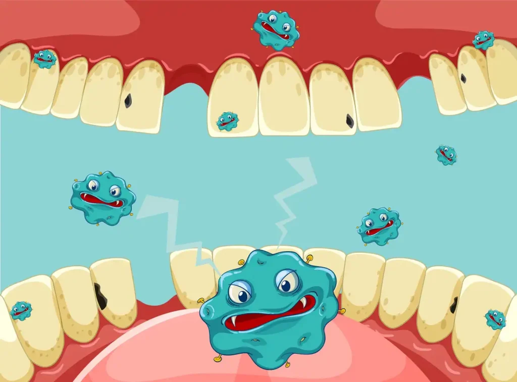 როგორ გავიხეხოთ კბილები სწორად 5 ნადები პირის ღრუში